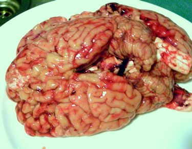 kalv's brains